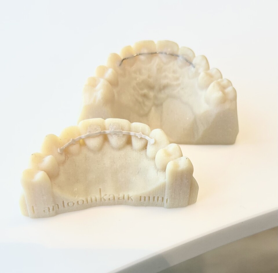 Metaalallergie Orthodontist Amsterdam Orthodontie